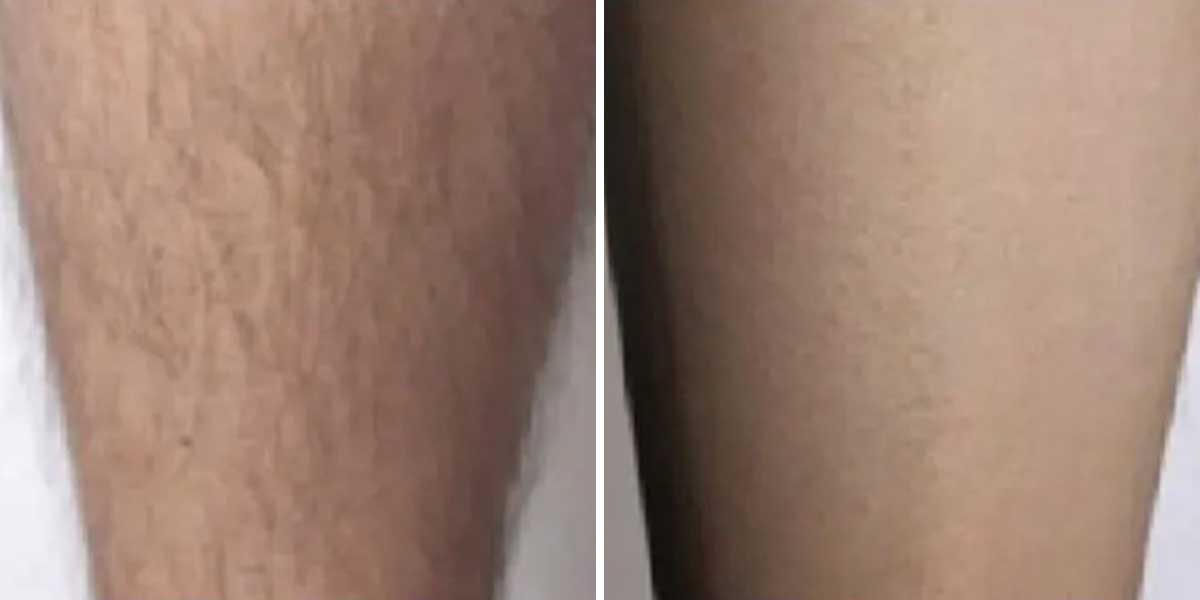 before-after-01