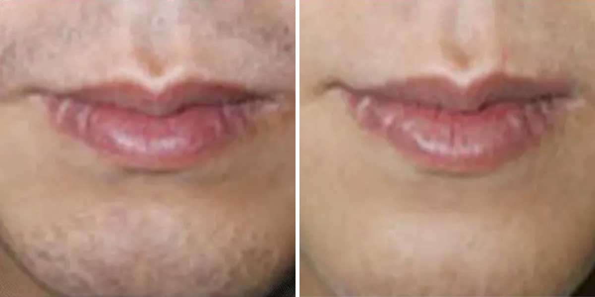 before-after-02