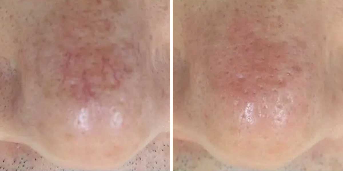 before-after-03