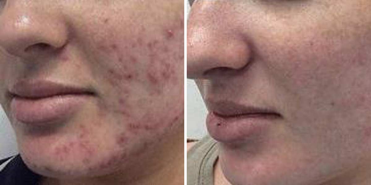 before-after-01