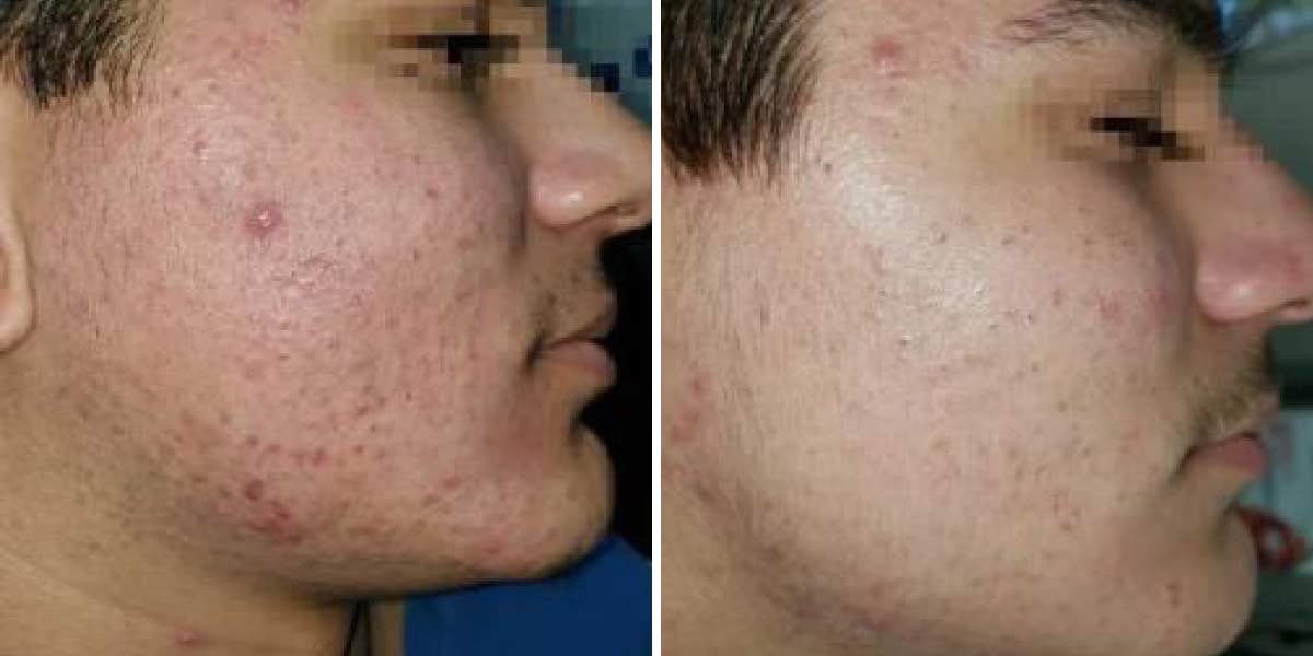 before-after-03
