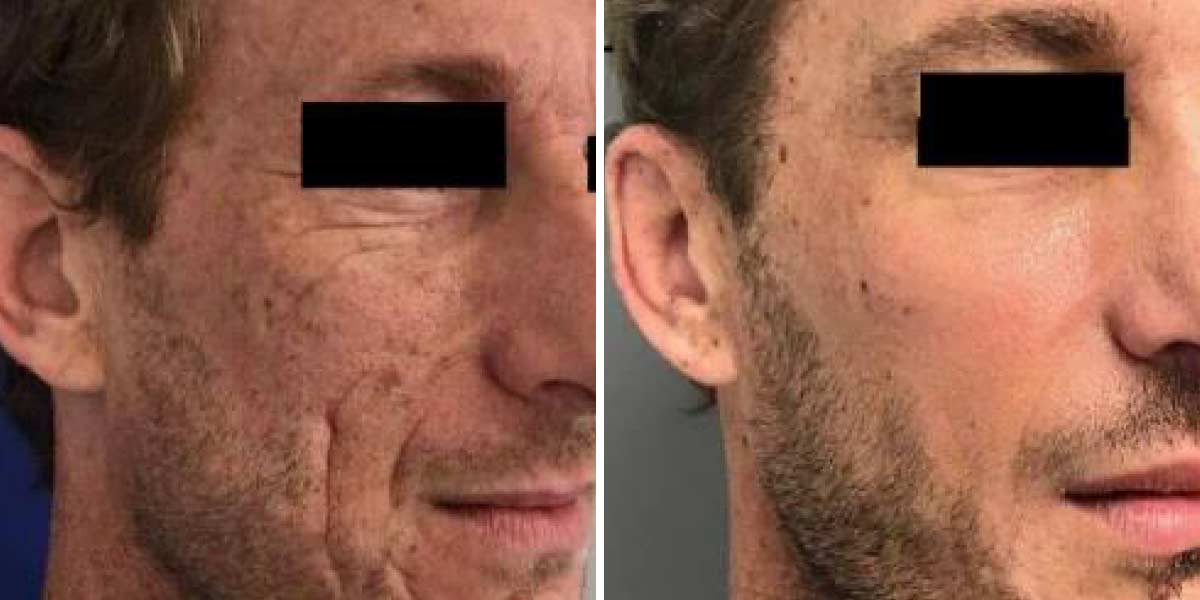 before-after-04